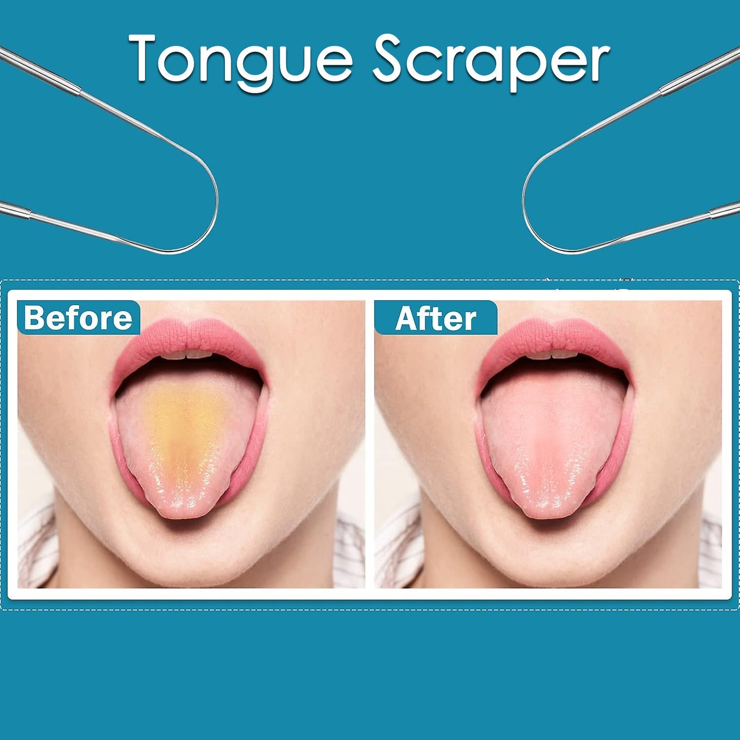 Tongue Cleaner For Kids & Adults | Tongue Scraper For Bad Breath, Maintain Oral Hygiene for Daily Use | for Fresh Breath & Bacteria Removal | Improved Taste (Steel, Copper, Tongue Cleaner / 1 Pc) Tongue Cleaner For Kids & Adults | Tongue Scraper For Bad Breath, Maintain Oral Hygiene for Daily Use | for Fresh Breath & Bacteria Removal | Improved Taste (Steel, Copper, Tongue Cleaner / 1 Pc)